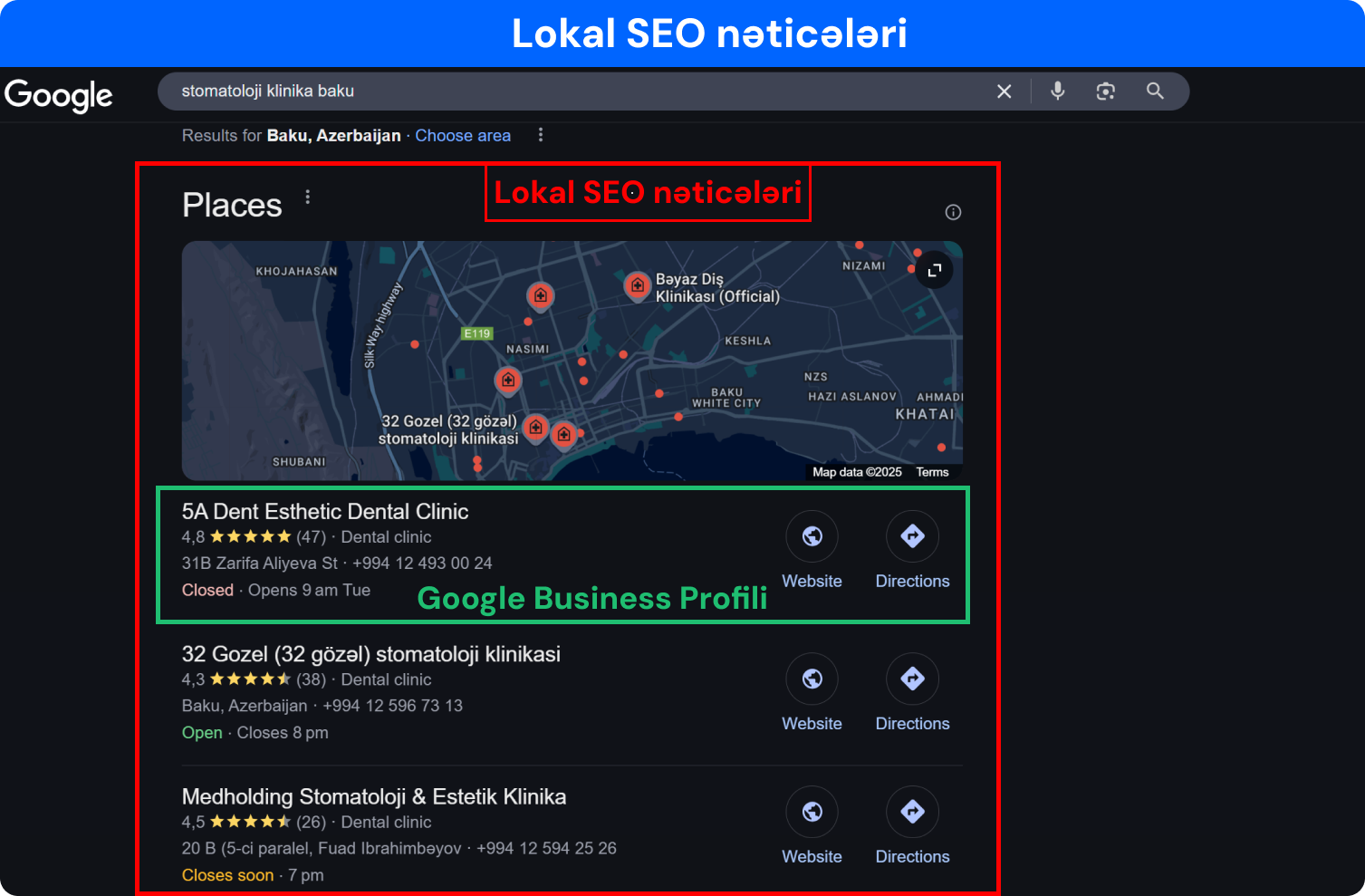 Google SERP-də lokal SEO nəticəsi